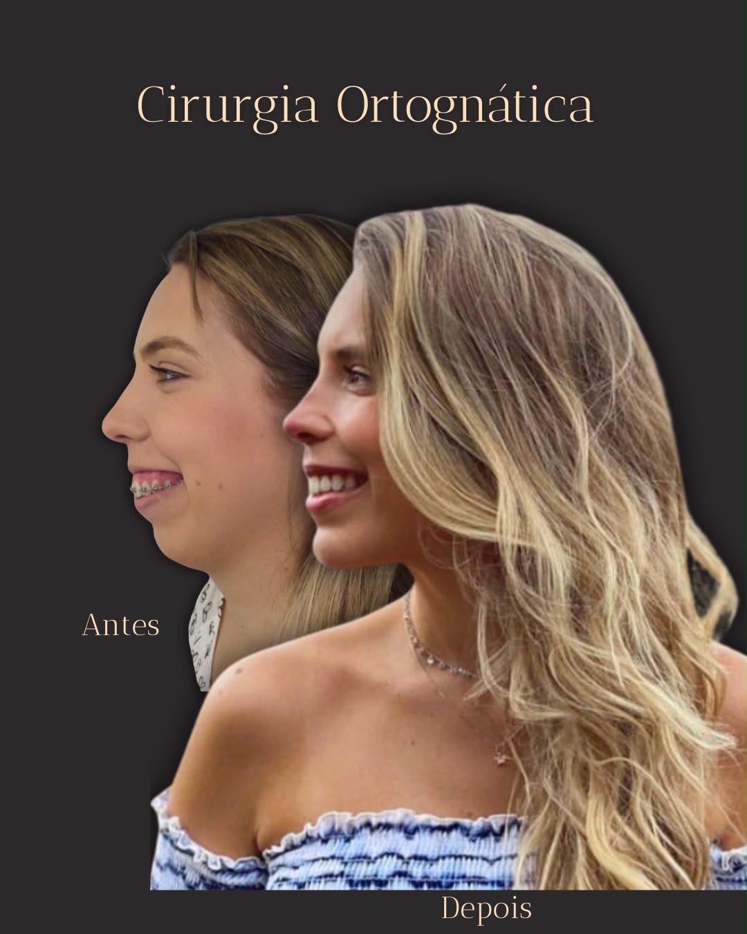 Antes e depois 2
